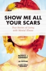 Show Me All Your Scars: True Stories of Living with Mental Illness By Lee Gutkind (Editor), Karen Wolk Feinstein (Foreword by), Patrick J. Kennedy (Introduction by) Cover Image